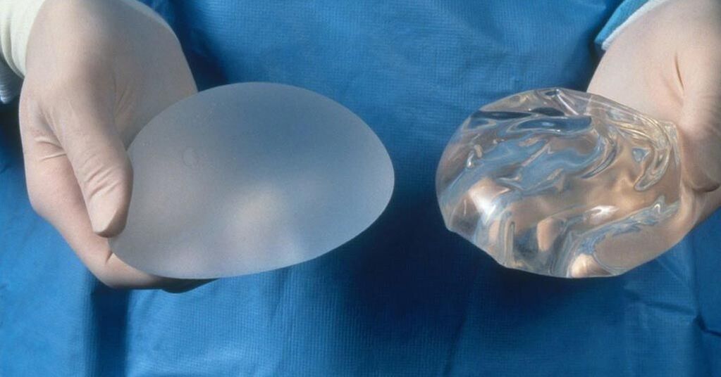 implantat